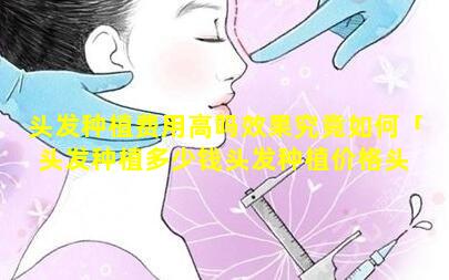 头发种植费用高吗效果究竟如何「头发种植多少钱头发种植价格头 🐟 发种植费用」